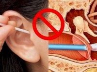 Ведущий в мире специалист по «ухо-горло-носу» раскрывает «Почему нельзя чистить уши ватными палочками»!