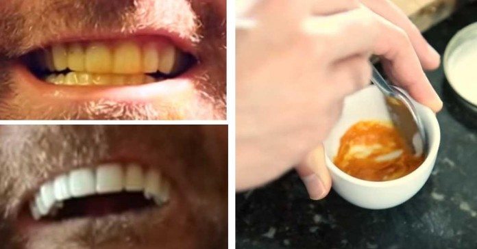 Этот мужчина показал до смешного простой трюк для отбеливания зубов. С секретным ингредиентом!