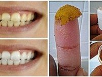 Будьте сами стоматологом! Вылечите кариес, десна и отбелите зубы с этой НАТУРАЛЬНОЙ зубной пастой!