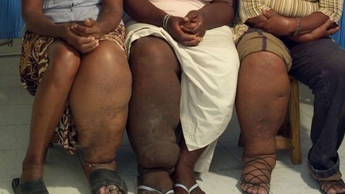 Вы знали, что ваша рука может задушить вас во сне? 12 самых редких и странных болезней