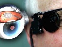 Первый в мире бионический глаз вернет зрение слепым людям!