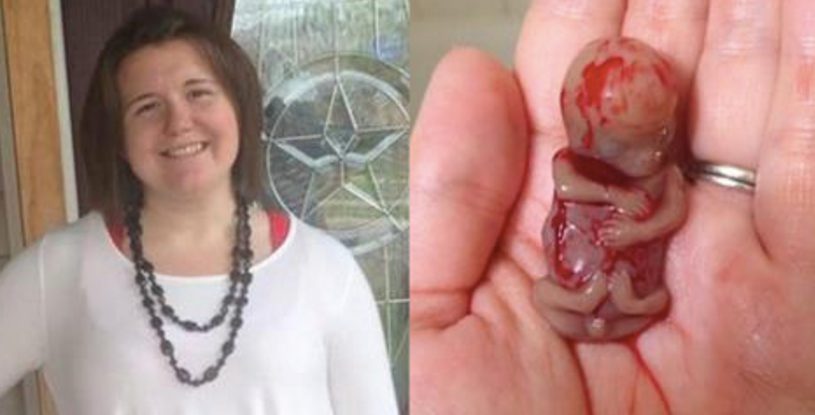 Ему было всего 11 недель. То, что показывает эта мать, поражает и заставляет задуматься